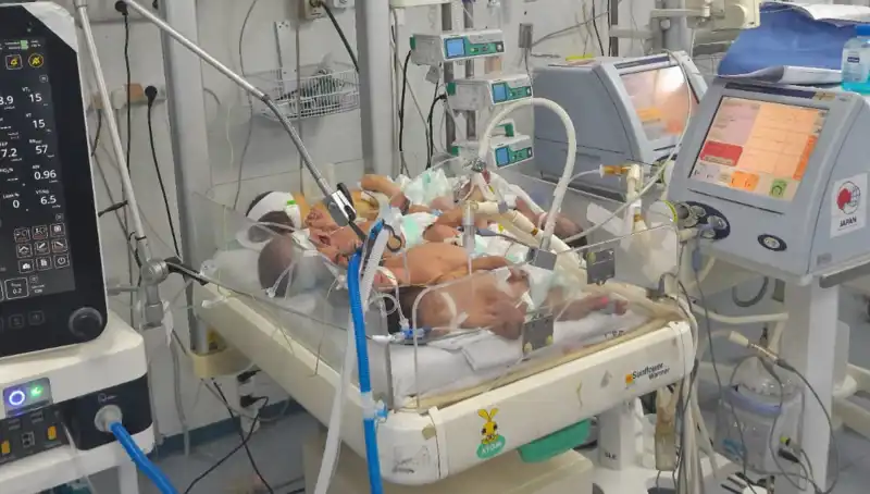 Gazzeli Doktorların Çaresizliği: "Aynı Kuvözde Birden Fazla Bebek Görüyoruz"