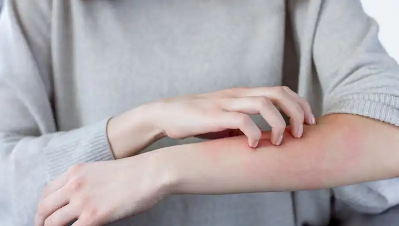 Cilt Kanserinin Gözden Kaçan İki Belirtisi: Dermatologların Önerileri