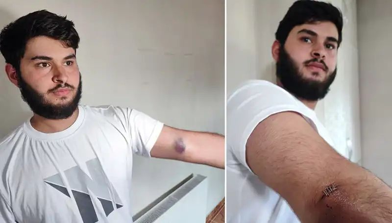 Bahçeye Kaçan Top, Mahallede Gözler Kamaştırdı: Conoların Kamyonetli Gelişi!